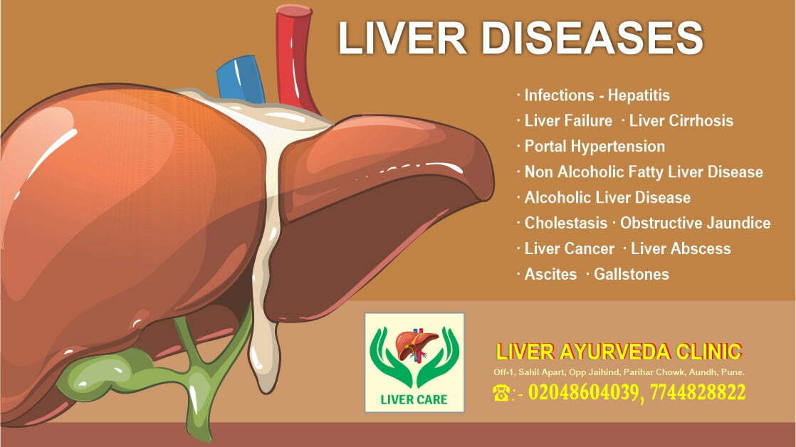 ayurvedic medicine for liver