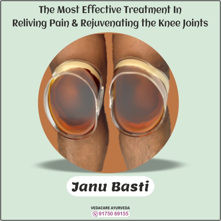Janu Basti For Knee Pain without operation