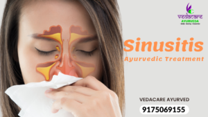 Sinusitis Treatment In Ayurveda