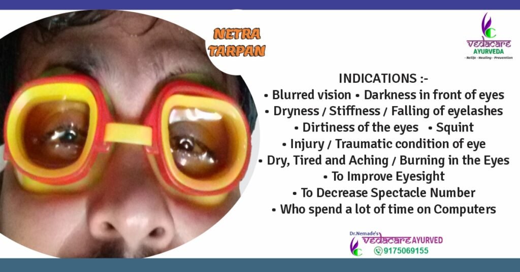 Netra Tarpan Ayurvedic eye therapy with ghee for dry eyes, eye strain, and vision improvement – traditional Panchakarma treatment at Vedacare Ayurveda Clinic