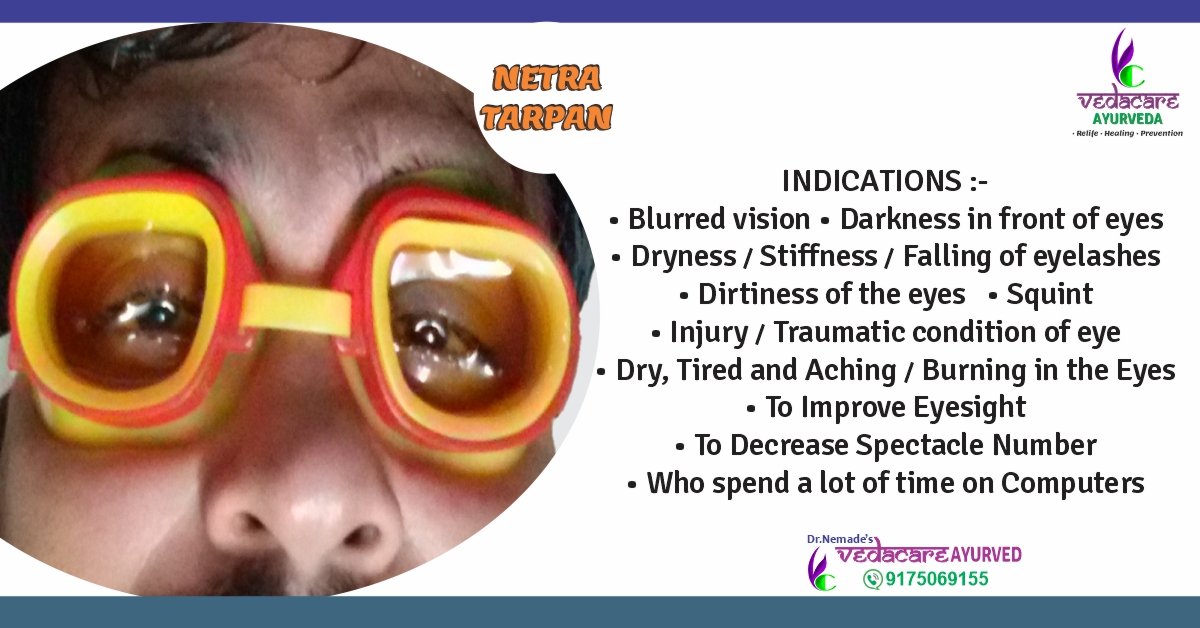 Netra Tarpan Ayurvedic eye therapy with ghee for dry eyes, eye strain, and vision improvement – traditional Panchakarma treatment at Vedacare Ayurveda Clinic