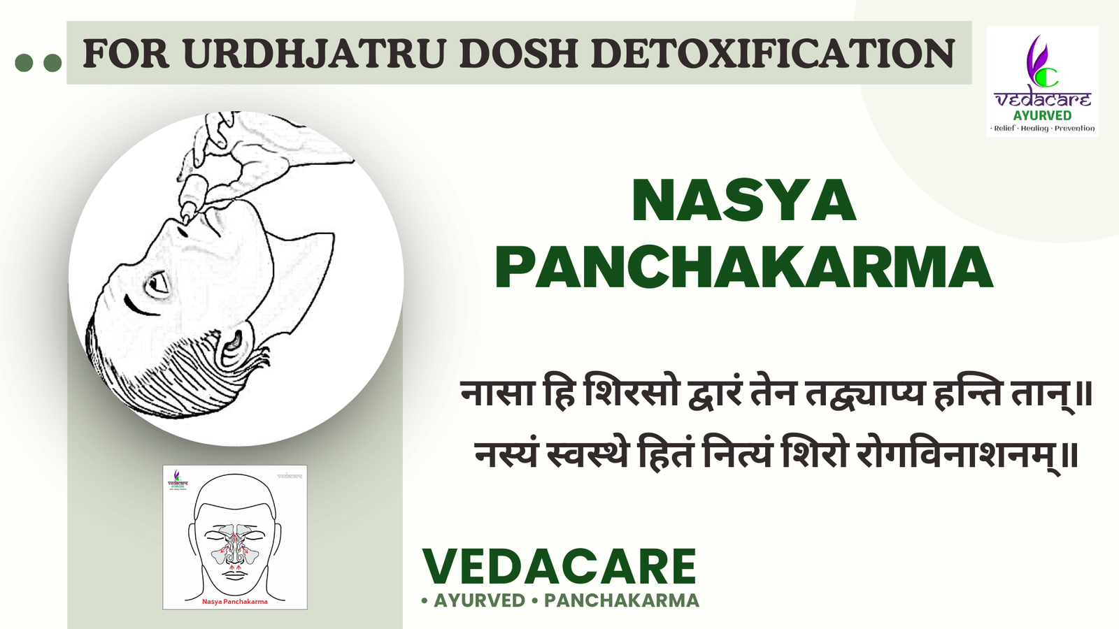 Nasya Panchakarma Ayurvedic nasal therapy with herbal oils, performed by a practitioner on a patient, promoting sinus relief and mental clarity in a serene spa-like setting.