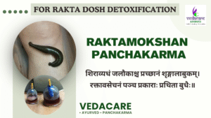 Ayurvedic Raktamokshan therapy using medicinal leeches for blood detoxification