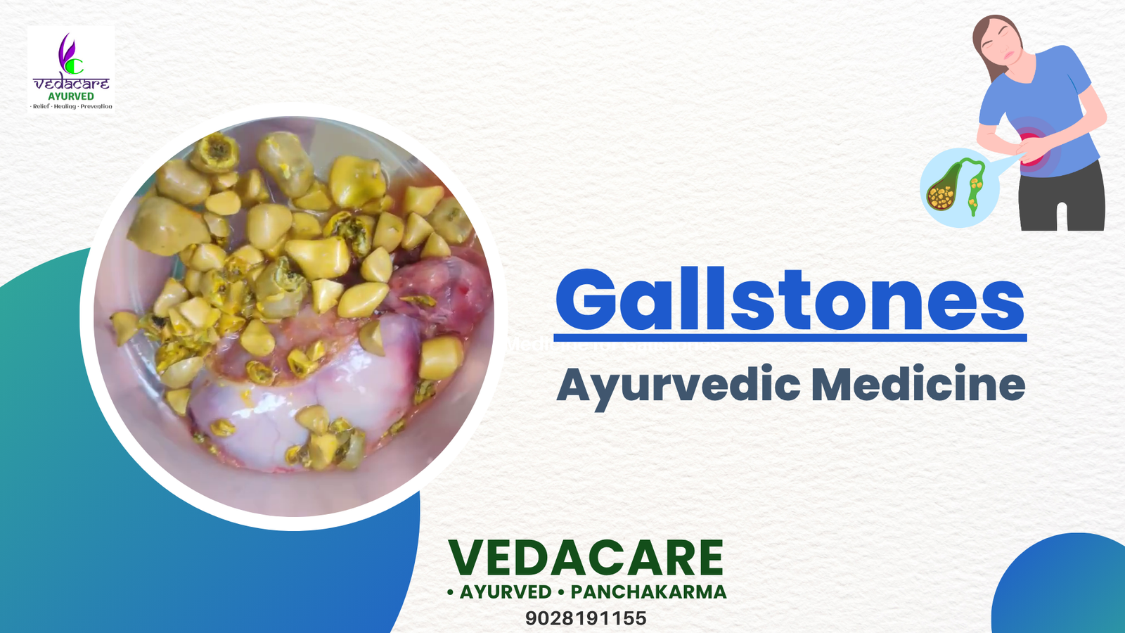 gallstones ayurvedic treatment