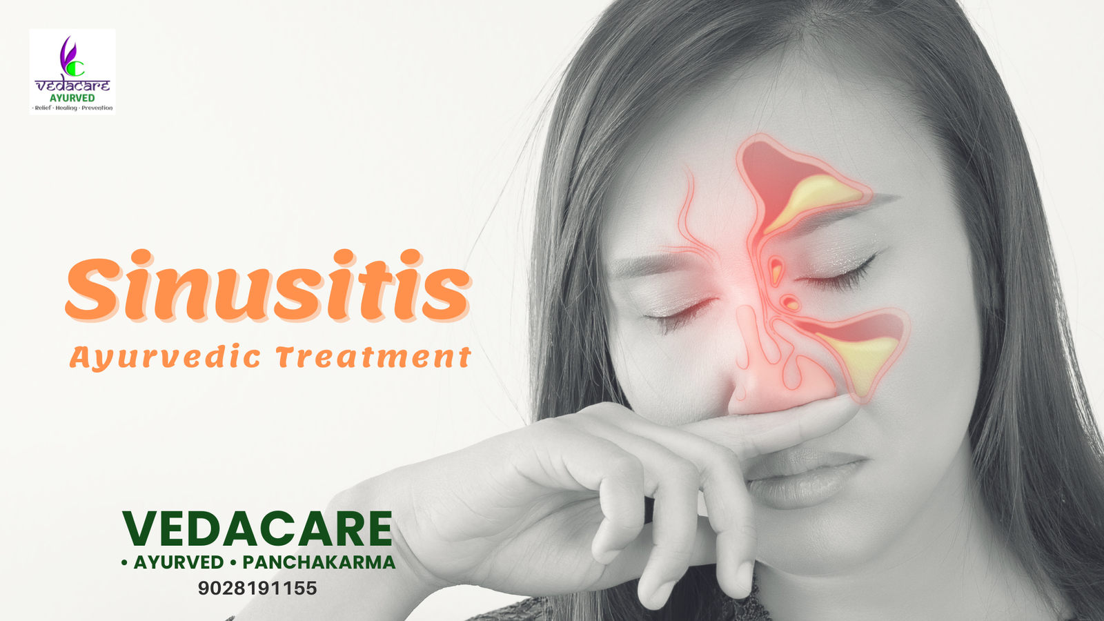 sinusitis ayurvedic treamtnet